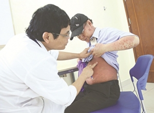 Bệnh xơ gan có mấy giai đoan? Giai đoạn nào nguy hiểm nhất?